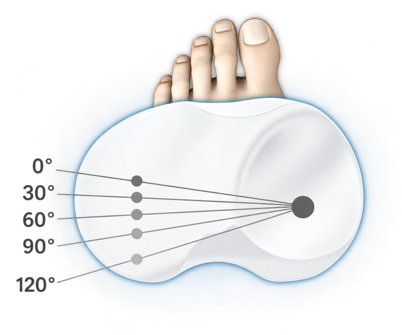 משתלי Medial Pivot- ניסיון לשחזר את התנועה הטבעית של הברך
